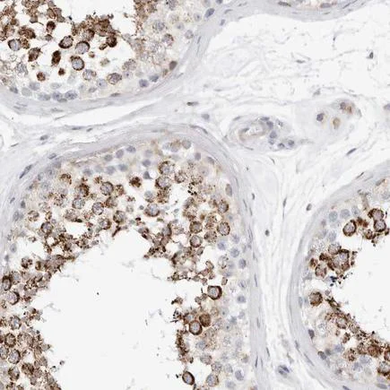 Immunohistochemistry (Formalin/PFA-fixed paraffin-embedded sections) - Anti-ATPase Inhibitory Factor 1/IF1 antibody (AB223779)