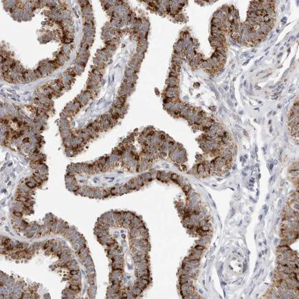 Immunohistochemistry (Formalin/PFA-fixed paraffin-embedded sections) - Anti-ATPase Inhibitory Factor 1/IF1 antibody (AB223779)