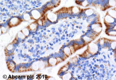 Immunohistochemistry (Formalin/PFA-fixed paraffin-embedded sections) - Anti-ATPB antibody [3D5] - Mitochondrial Marker (AB14730), expandable thumbnail