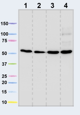 Western blot - Anti-ATPB antibody [3D5] - Mitochondrial Marker (AB14730), expandable thumbnail
