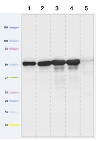 Western blot - Anti-ATPB antibody [7E3F2] - Mitochondrial Marker (AB110280), expandable thumbnail