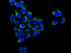 Immunocytochemistry/ Immunofluorescence - Anti-ATPB antibody [EPR11990] - Mitochondrial Marker (ab170947), expandable thumbnail