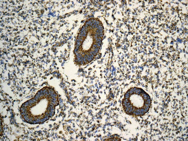 Immunohistochemistry (Formalin/PFA-fixed paraffin-embedded sections) - Anti-ATPB antibody [EPR11990] (AB170947), expandable thumbnail
