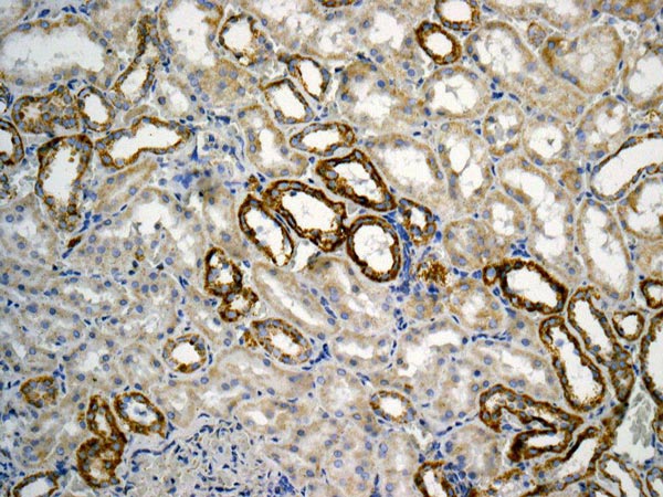 Immunohistochemistry (Formalin/PFA-fixed paraffin-embedded sections) - Anti-ATPB antibody [EPR11990] - Mitochondrial Marker (AB170947), expandable thumbnail