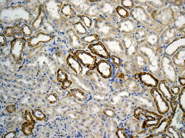Immunohistochemistry (Formalin/PFA-fixed paraffin-embedded sections) - Anti-ATPB antibody [EPR11990] - Mitochondrial Marker (AB170947)