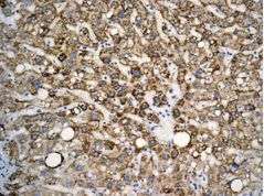 Immunohistochemistry (Formalin/PFA-fixed paraffin-embedded sections) - Anti-ATPB antibody [EPR11990] (ab170947), expandable thumbnail