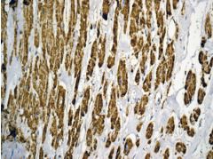Immunohistochemistry (Formalin/PFA-fixed paraffin-embedded sections) - Anti-ATPB antibody [EPR11990] (ab170947), expandable thumbnail