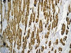 Immunohistochemistry (Formalin/PFA-fixed paraffin-embedded sections) - Anti-ATPB antibody [EPR11990] - Mitochondrial Marker (AB170947)