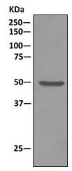 Immunoprecipitation - Anti-ATPB antibody [EPR11990] - Mitochondrial Marker (AB170947), expandable thumbnail