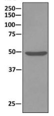Immunoprecipitation - Anti-ATPB antibody [EPR11991] - Mitochondrial Marker (AB170948), expandable thumbnail