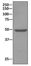 Immunoprecipitation - Anti-ATPB antibody [EPR11991] - Mitochondrial Marker (AB170948)