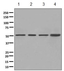 Western blot - Anti-ATPB antibody [EPR11991] - Mitochondrial Marker (AB170948), expandable thumbnail