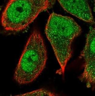 Immunocytochemistry/ Immunofluorescence - Anti-ATPBD3 antibody (AB185473), expandable thumbnail