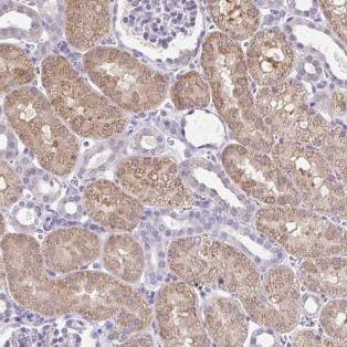 Immunohistochemistry (Formalin/PFA-fixed paraffin-embedded sections) - Anti-ATPBD3 antibody (AB185473), expandable thumbnail