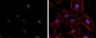 Immunocytochemistry/ Immunofluorescence - Anti-ATR antibody (AB184137)