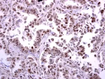 Immunohistochemistry (Formalin/PFA-fixed paraffin-embedded sections) - Anti-ATR antibody (AB184137)