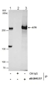 Immunoprecipitation - Anti-ATR antibody (AB184137)
