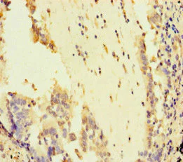 Immunohistochemistry (Formalin/PFA-fixed paraffin-embedded sections) - Anti-ATR antibody (AB222820)