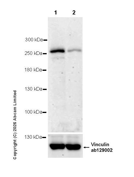 Western blot - Anti-ATR antibody [EPR30640-130] (AB325605)