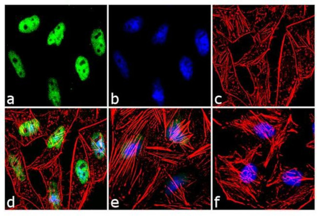 Immunocytochemistry/ Immunofluorescence - Anti-ATR antibody [RP23040105] (AB313435)