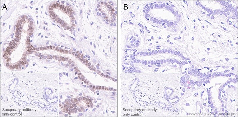 Immunohistochemistry (Formalin/PFA-fixed paraffin-embedded sections) - Anti-ATR (phospho S428) antibody [EPR2184] (AB178407), expandable thumbnail