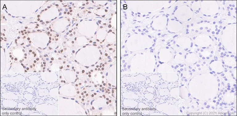 Immunohistochemistry (Formalin/PFA-fixed paraffin-embedded sections) - Anti-ATR (phospho S428) antibody [EPR2184] (AB178407)