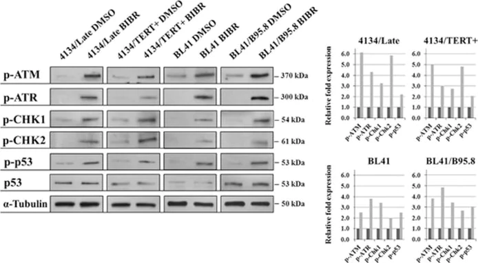 Western blot - Anti-ATR (phospho S428) antibody [EPR2184] (AB178407)