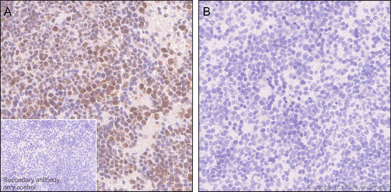 Immunohistochemistry (Formalin/PFA-fixed paraffin-embedded sections) - Anti-ATR (phospho S428) antibody [EPR25772-3F09] (AB316925)