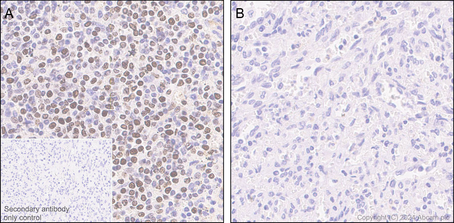Immunohistochemistry (Formalin/PFA-fixed paraffin-embedded sections) - Anti-ATR (phospho S428) antibody [EPR25772-3F09] - BSA and Azide free (AB316926), expandable thumbnail