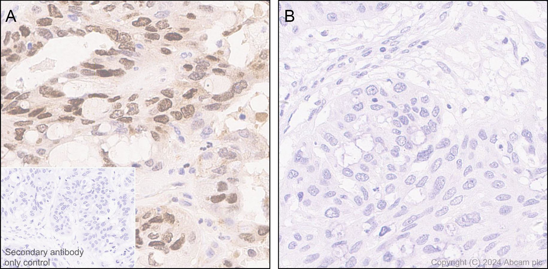 Immunohistochemistry (Formalin/PFA-fixed paraffin-embedded sections) - Anti-ATR (phospho S428) antibody [EPR25772-3F09] - BSA and Azide free (AB316926), expandable thumbnail