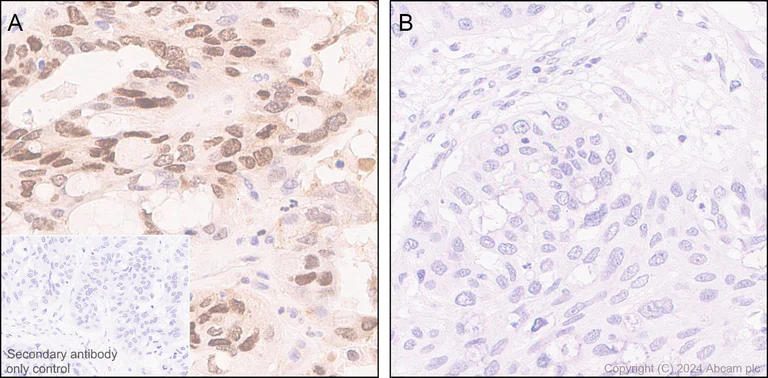 Immunohistochemistry (Formalin/PFA-fixed paraffin-embedded sections) - Anti-ATR (phospho S428) antibody [EPR25772-3F09] - BSA and Azide free (AB316926)