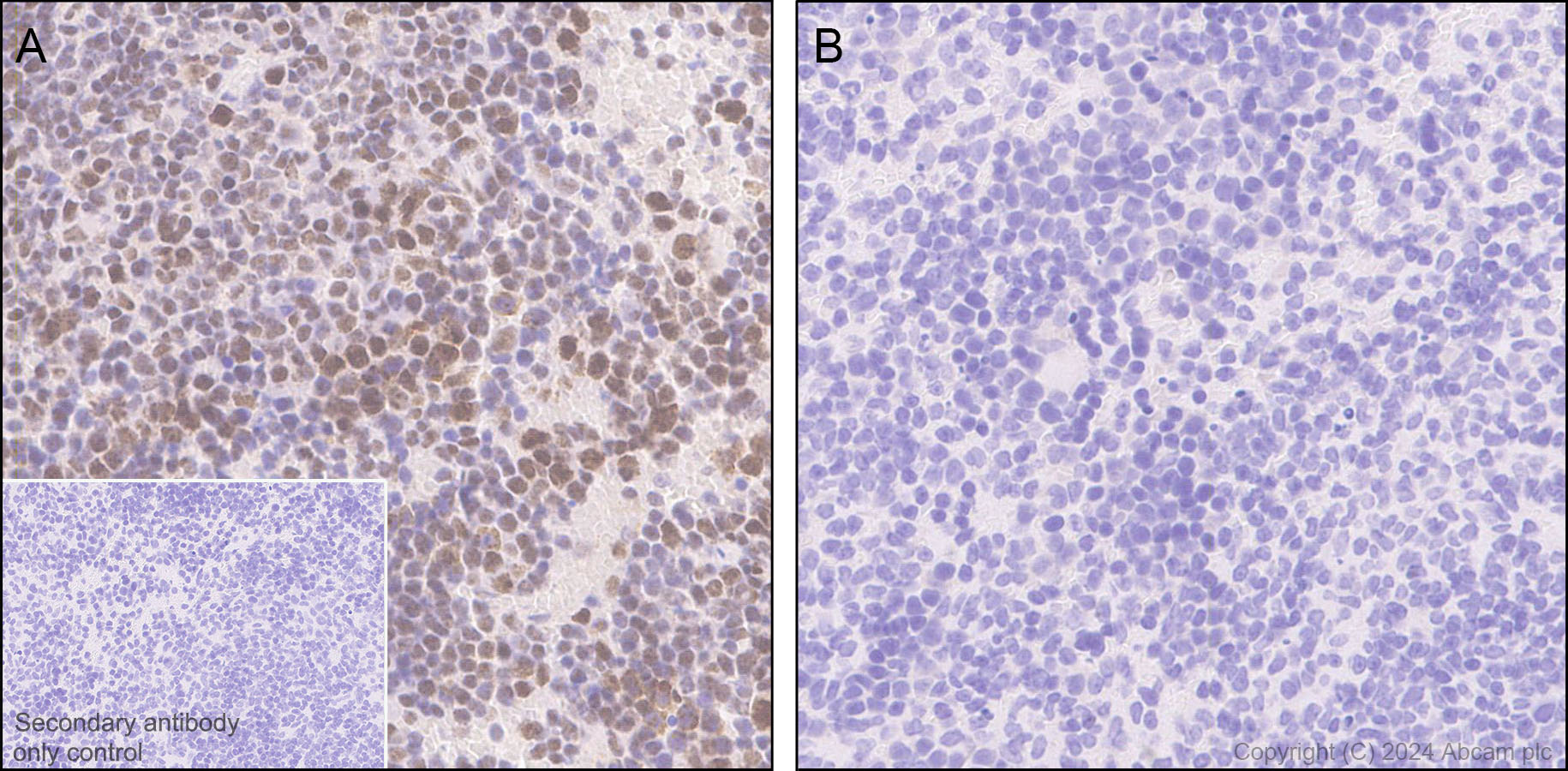 Immunohistochemistry (Formalin/PFA-fixed paraffin-embedded sections) - Anti-ATR (phospho S428) antibody [EPR25772-3F09] - BSA and Azide free (AB316926), expandable thumbnail