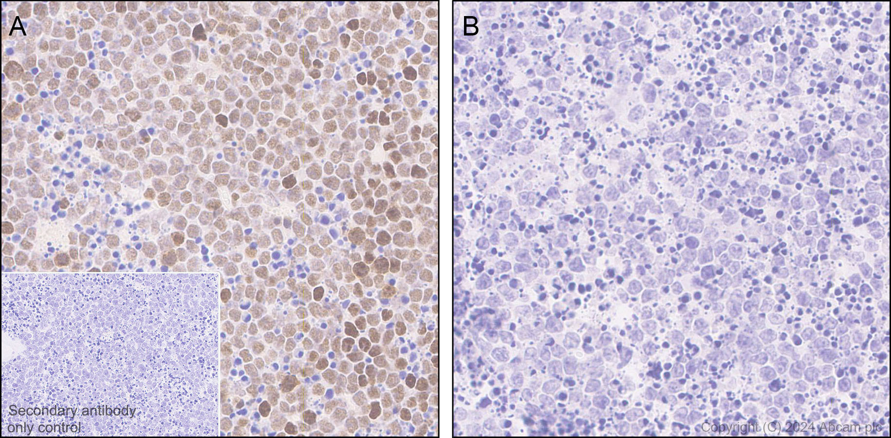 Immunohistochemistry (Formalin/PFA-fixed paraffin-embedded sections) - Anti-ATR (phospho S428) antibody [EPR25772-3F09] - BSA and Azide free (AB316926), expandable thumbnail