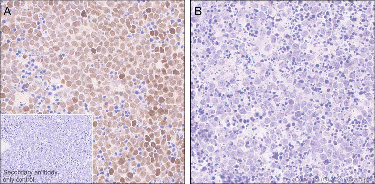 Immunohistochemistry (Formalin/PFA-fixed paraffin-embedded sections) - Anti-ATR (phospho S428) antibody [EPR25772-3F09] - BSA and Azide free (AB316926)
