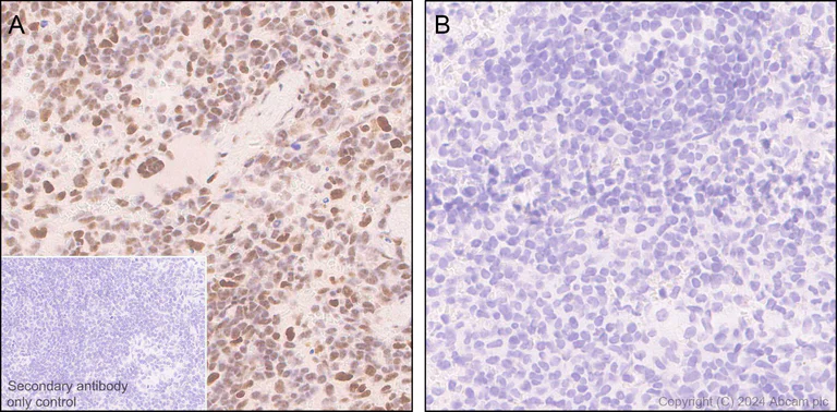 Immunohistochemistry (Formalin/PFA-fixed paraffin-embedded sections) - Anti-ATR (phospho S428) antibody [EPR25772-3F09] - BSA and Azide free (AB316926)