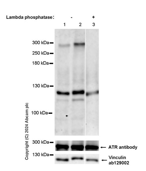 Western blot - Anti-ATR (phospho S428) antibody [EPR25772-3F09] - BSA and Azide free (ab316926), expandable thumbnail