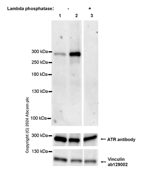 Western blot - Anti-ATR (phospho S428) antibody [EPR25772-3F09] - BSA and Azide free (AB316926)