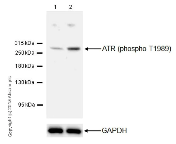 Western blot - Anti-ATR (phospho T1989) antibody [EPR21991] (AB223258)