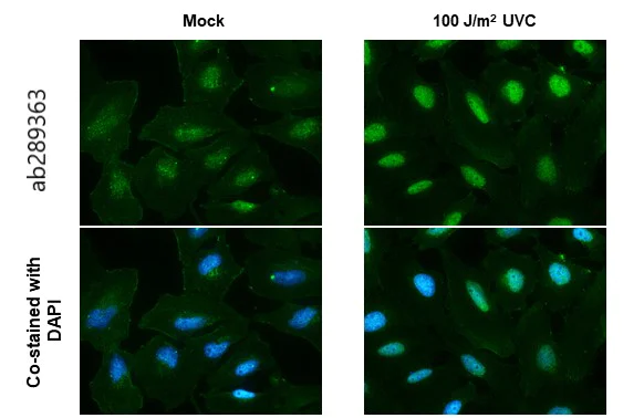Immunocytochemistry/ Immunofluorescence - Anti-ATR (phospho T1989) antibody [HL132] - BSA and Azide free (AB289363)