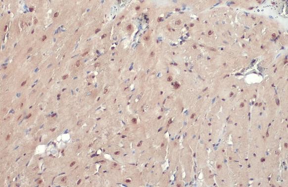 Immunohistochemistry (Formalin/PFA-fixed paraffin-embedded sections) - Anti-ATR (phospho T1989) antibody [HL132] - BSA and Azide free (AB289363), expandable thumbnail