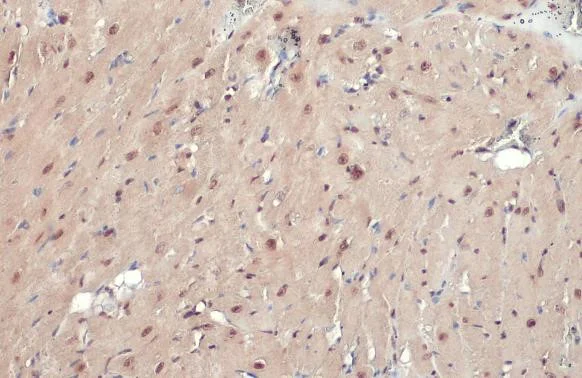 Immunohistochemistry (Formalin/PFA-fixed paraffin-embedded sections) - Anti-ATR (phospho T1989) antibody [HL132] - BSA and Azide free (AB289363)