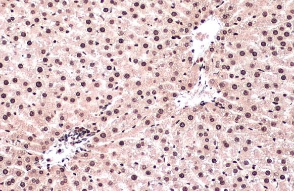 Immunohistochemistry (Formalin/PFA-fixed paraffin-embedded sections) - Anti-ATR (phospho T1989) antibody [HL132] - BSA and Azide free (AB289363), expandable thumbnail