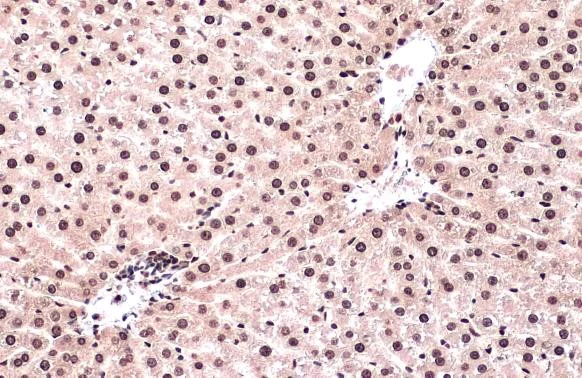 Immunohistochemistry (Formalin/PFA-fixed paraffin-embedded sections) - Anti-ATR (phospho T1989) antibody [HL132] - BSA and Azide free (AB289363)