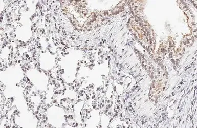 Immunohistochemistry (Formalin/PFA-fixed paraffin-embedded sections) - Anti-ATR (phospho T1989) antibody [HL132] - BSA and Azide free (AB289363)
