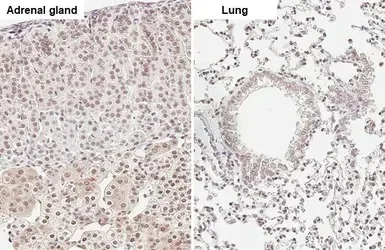 Immunohistochemistry (Formalin/PFA-fixed paraffin-embedded sections) - Anti-ATR (phospho T1989) antibody [HL132] - BSA and Azide free (AB289363)