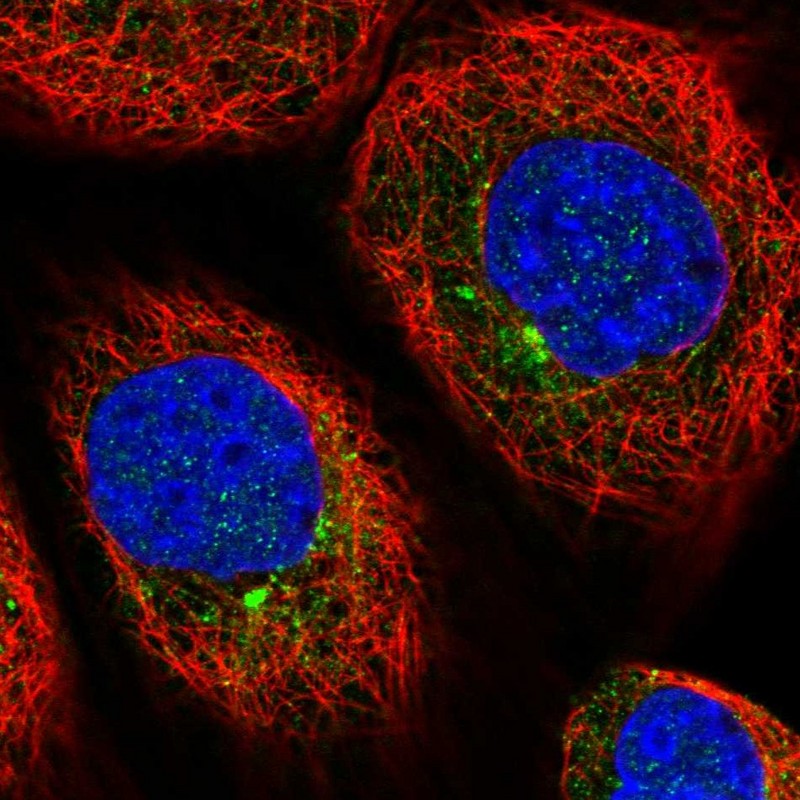 Immunocytochemistry/ Immunofluorescence - Anti-ATRAP antibody (AB251901), expandable thumbnail
