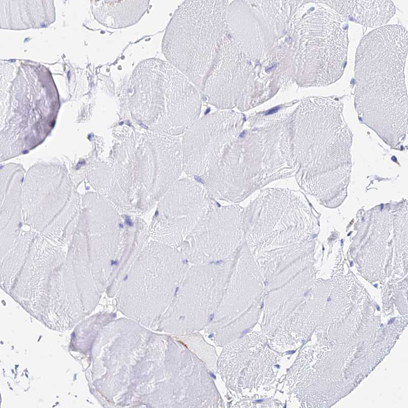 Immunohistochemistry (Formalin/PFA-fixed paraffin-embedded sections) - Anti-ATRAP antibody (AB251901), expandable thumbnail
