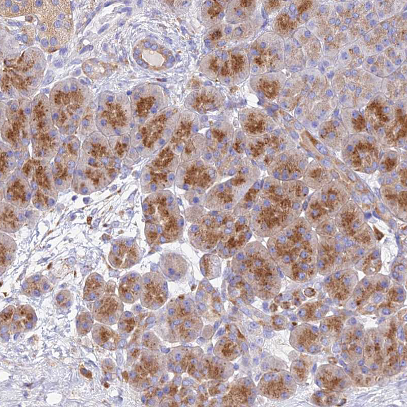 Immunohistochemistry (Formalin/PFA-fixed paraffin-embedded sections) - Anti-ATRAP antibody (AB251901), expandable thumbnail