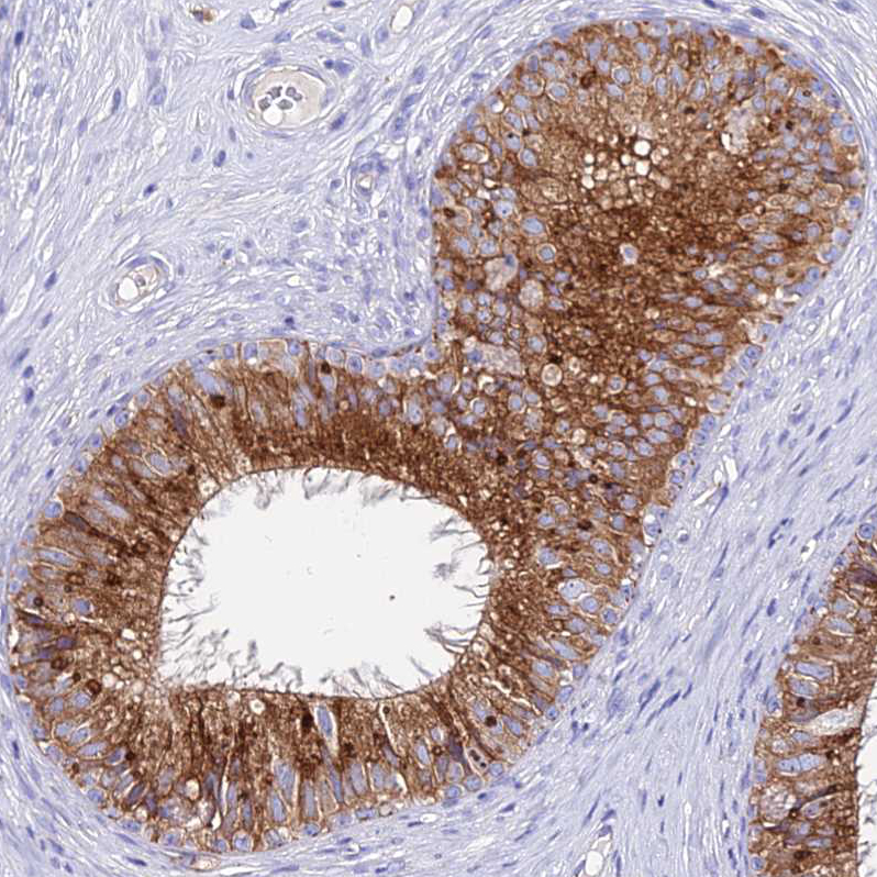 Immunohistochemistry (Formalin/PFA-fixed paraffin-embedded sections) - Anti-ATRAP antibody (ab251901), expandable thumbnail