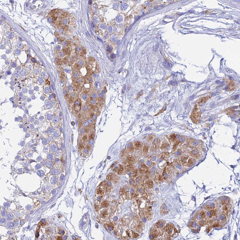 Immunohistochemistry (Formalin/PFA-fixed paraffin-embedded sections) - Anti-ATRAP antibody (AB251901), expandable thumbnail